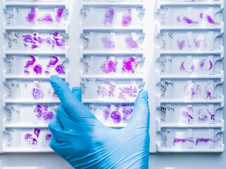 Hand in blue glove holding glass histology slides