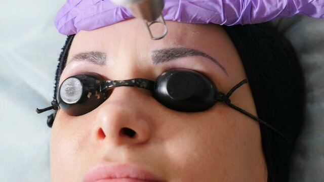 Laser eyebrow tattooing removing. Permanent make-up and tattoos removal. Getting rid of permanent makeup in salon. Female client getting eyebrows tattoo correction. picosecond laser device. 4 k video