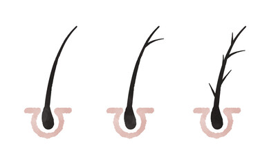 Cute hair root illustration set - obrazy, fototapety, plakaty