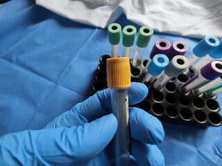 Persona sosteniendo un tubo de laboratorio