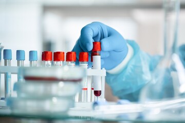Scientist hold blood sample tube for A covid-19 vaccine. Doctor's hand holds a bottle with a...