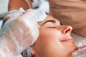 White pencil markings on the patient's face for botox injection in the eye