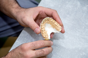 doctor working with a layout of teeth. Mold of teeth in the hands of a doctor