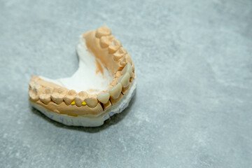 layout of teeth on the table Dental impression of teeth