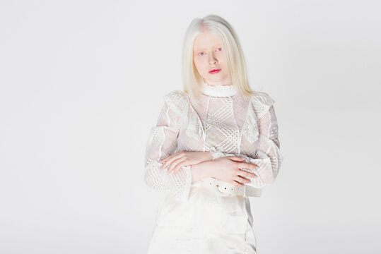 Young albino woman in stylish blouse looking at camera isolated on white.