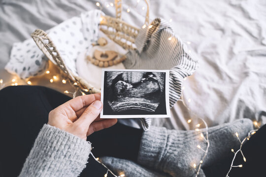 Pregnant woman with wicker basket of newborn clothes, ultrasound image, toy. Expectant mother waiting for baby birth during pregnancy. Concept of maternity, baby shower party, winter holidays.
