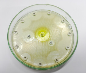 Antimicrobial susceptibility testing in culture plate. Drug sensitivity test, disk drug, antibiotic sensitivity. All basic usable antibiotic are sensitive eccept Levofloxacin antibiotic.