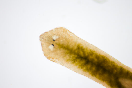 Planarian parasite (flatworm) under microscope view.