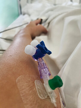 Cannula in arm on Hospital Bed