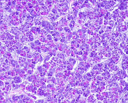 Anterior Pituitary. Gomori Trichrome Stain