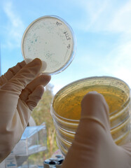 Looking at bacterial colonies in petri dish.
