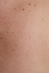 Skin closeup