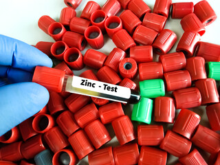 Blood sample tube for Zinc test at medical laboratory.