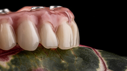 dental implants on a black background

