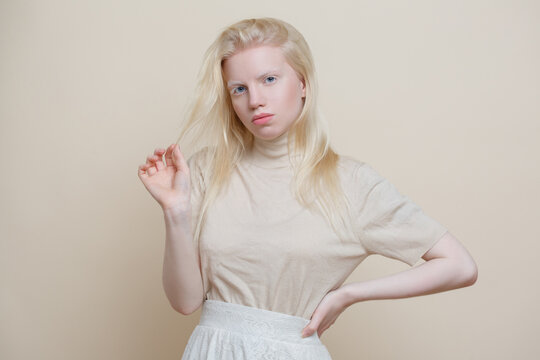 Cute albino girl  on a beige background.