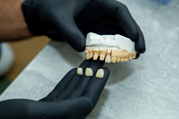 tooth mold for tooth restoration