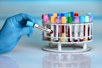 Doctor's hand holding blood sample tube of New Variant of Covid-19 called Omicron B.1.1.529....