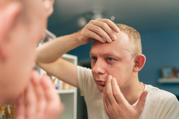 Man try putting on contact lenses in eye front bathroom mirror. Optic health treatment....