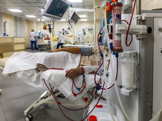 the patient undergoes a hemodialysis session-blood purification by hardware method.artificial kidney
