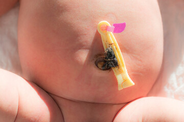 plano cenital de la barriga de un recién nacido y de su cordón umbilical