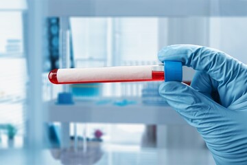 Doctor in the lab holding tubes of blood. Laboratory Technician with blood samples with a New...