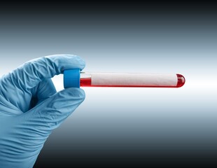 COVID-19 blood sample positive with coronavirus