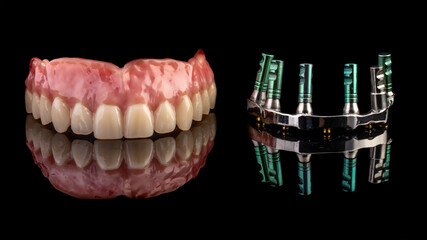 Dental implants and dentures in close-up Siemke on a black background

