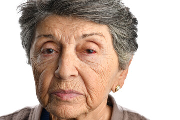 Portrait of a mature adult woman with red eye isolated on white background   