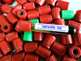 Blood sample for Lipid profile, LDH and  serum cholesterol testing
