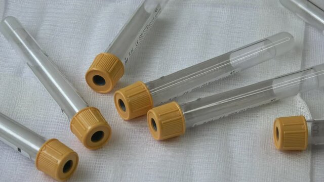 Medical sample tubes with Colorful Caps for different tests isolated white background