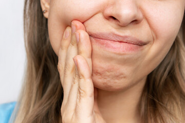 Cropped shot of a young blonde woman with a toothache holding her cheek isolated on a white...