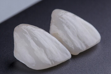 DENTAL VENEERS - LENTES DE CONTATO