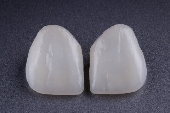 DENTAL VENEERS - LENTES DE CONTATO