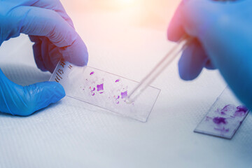 Hands in blue glove holding glass histology slides