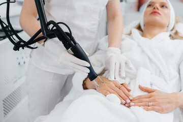 A young girl gets carbon peeling for the skin of her hands in a beauty salon. Laser pulses cleanse the skin. Hardware cosmetology. The process of photothermolysis, warming the skin.