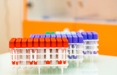 Medical stacks of analyzing blood tests. Laboratory microbiology scientific researchment.