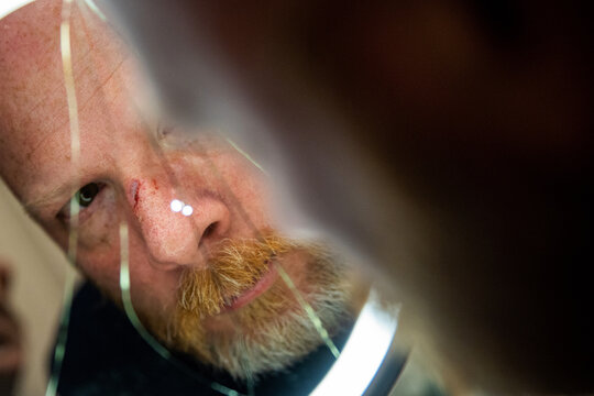 Middle aged man with a beard stares into a cracked mirror looking at the reflection the broken and bloody nose on his face. 
