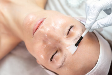 Close-up beautician doctor hand making anti-age procedure apply peeling acid young attractive...
