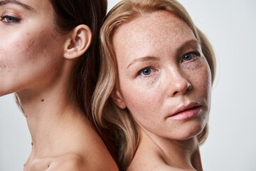 Diverse caucasian females looking at camera, posing, smiling, showing their appearance