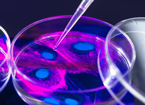 Pipetting of sample into Petri dish containing cell micrograph