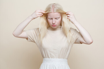 Cute albino girl  on a beige background. - obrazy, fototapety, plakaty