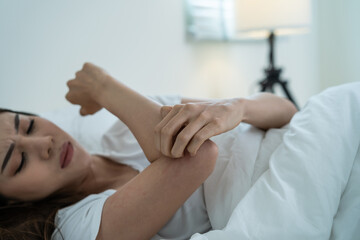 Fototapeta na wymiar Asian young woman scratch hand feel suffer from allergy while sleeping. Beautiful attractive girl lying on bed in bedroom suffering from itching arm skin allergic reaction to insect bites, dermatitis.
