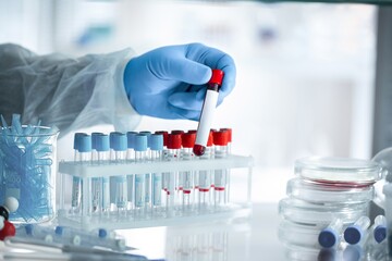 A covid-19 vaccine. Doctor's hand holds a bottle with a coronavirus vaccine