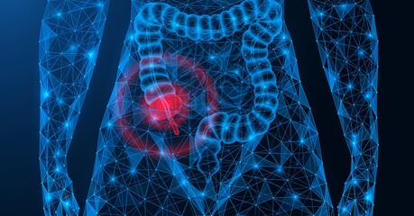 Appendicitis. Inflammation and pain in the appendix area. Polygonal construction of interconnected lines and points. Blue background.