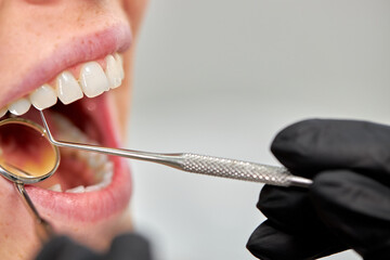 Dentist examining female patient's teeth, close up photo, corpped face. checkup in detal clinic by professional, using tools instruments in doctor's cabinet. copy space