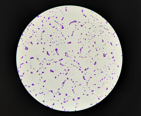 Bacteria methicillin-resistant Staphylococcus aureus MRSA, multidrug resistant bacteria, on surface...