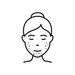 Woman with Blackhead, Acne, Rash on Face Line Icon. Girl with Pimples Face Outline Icon. Allergy, Inflammation Skin, Dermatologic Problem. Editable Stroke. Isolated Vector Illustration