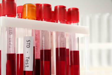 Tubes with blood samples in rack on white background, closeup. STD test