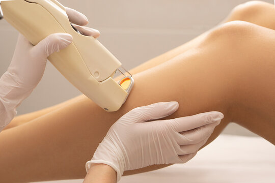 Close-up laser hair removal legs and female hands are holding the maniple of the laser device. laser hair removal process.