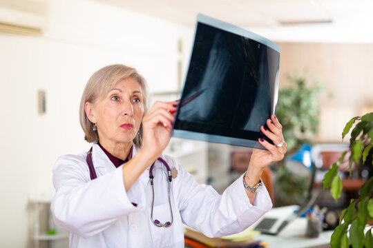 Qualified Focused Elderly Female Doctor Radiologist Examining X-ray Of Patient Foot After Injury In Hospital ..